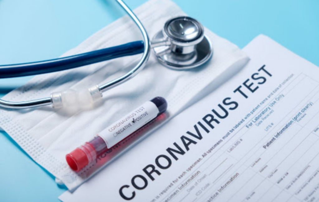 Coronavirus_test_02.jpg