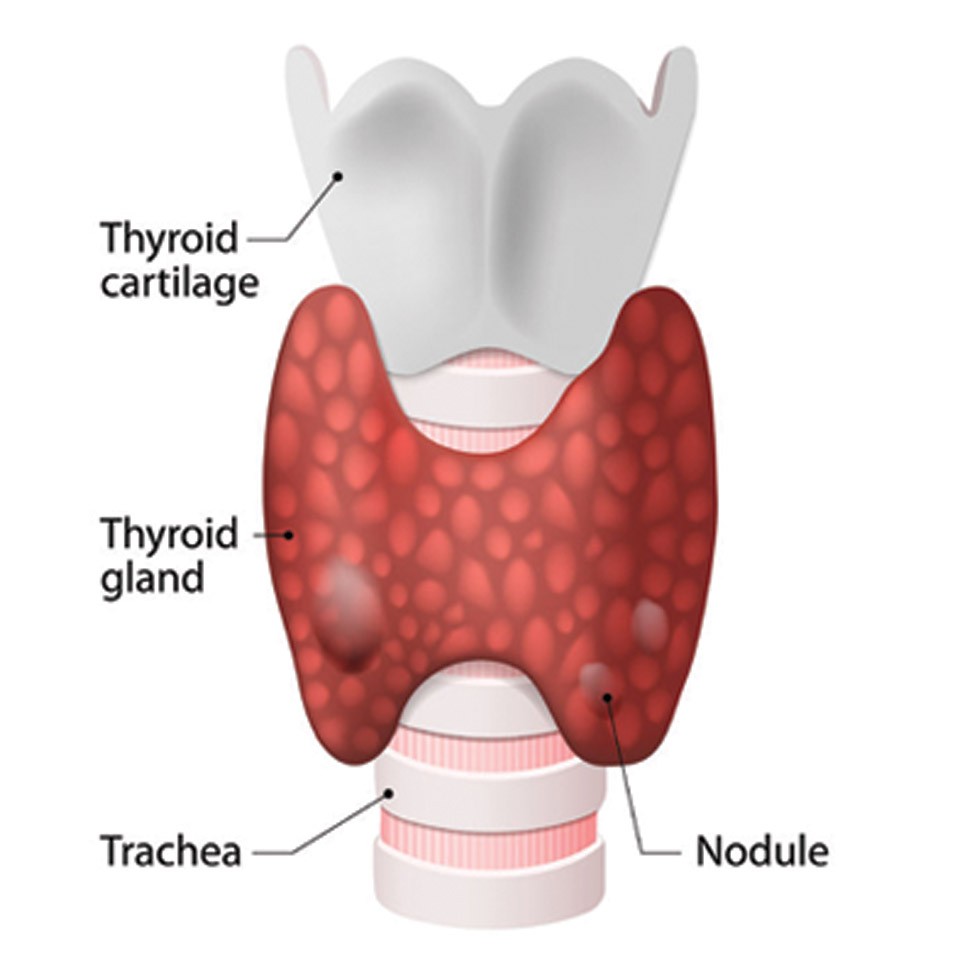Do-You-Have-A-Thyroid-Disorder.jpg