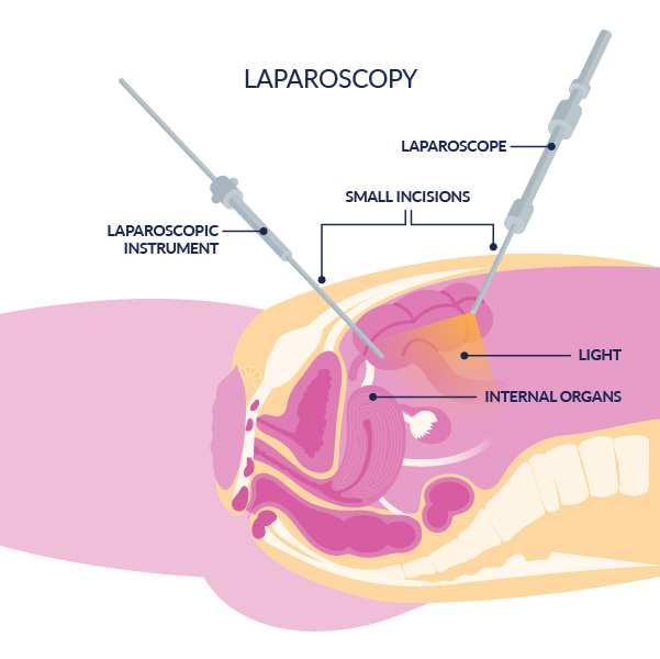laparoscopy_600px.jpg