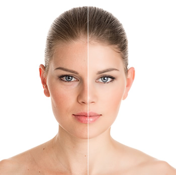 botox-treatment-la-mesa.jpg