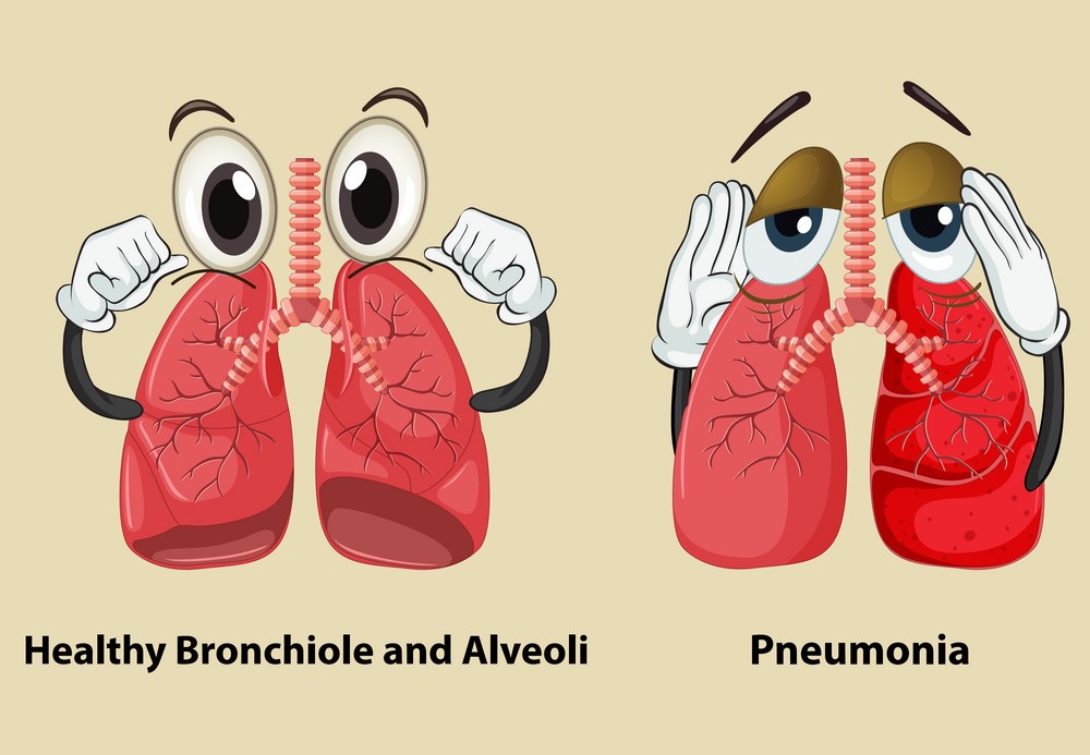 diagram-showing-healthy-and-pneumonia-lungs-vector-9914095.jpg