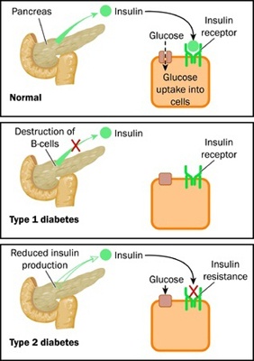 pancreas_action9933711_s250.jpg