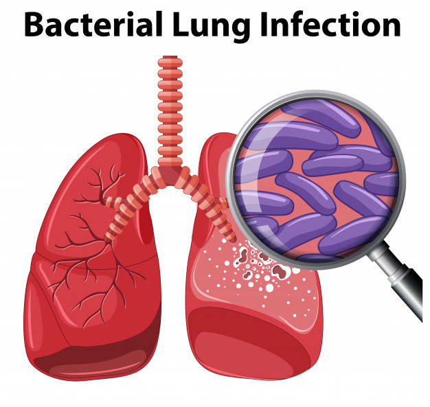 bacterial-lung-infection-white-background_1308-15015.jpg