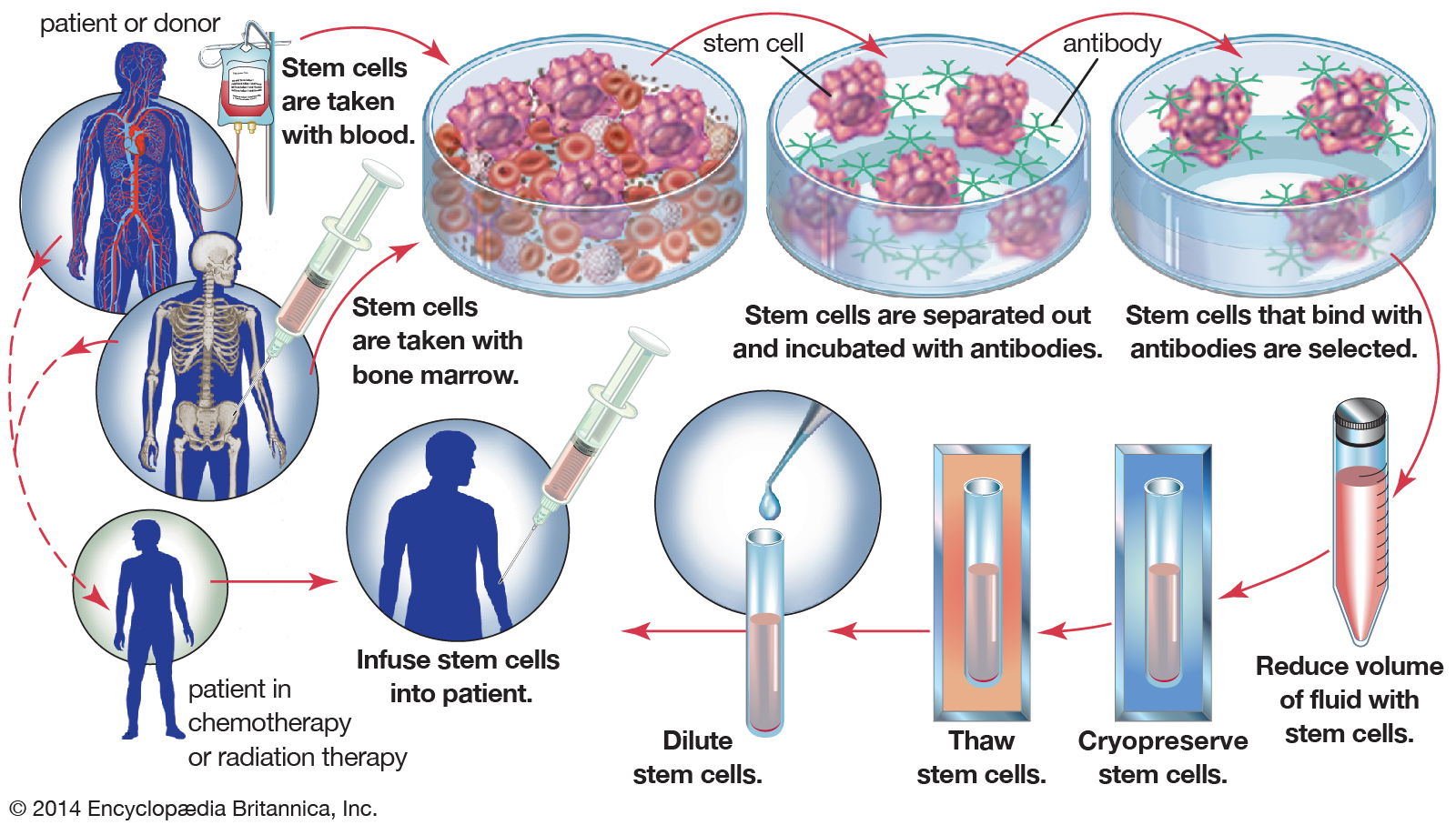 bone-marrow-stem-cells-cancer-radiation-chemotherapy.jpg