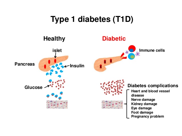 a-bacteria-in-the-gut-may-predict-type-1-diabetes-2-638.jpg