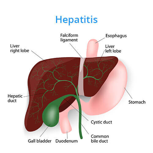 Hepatitis (1).jpg