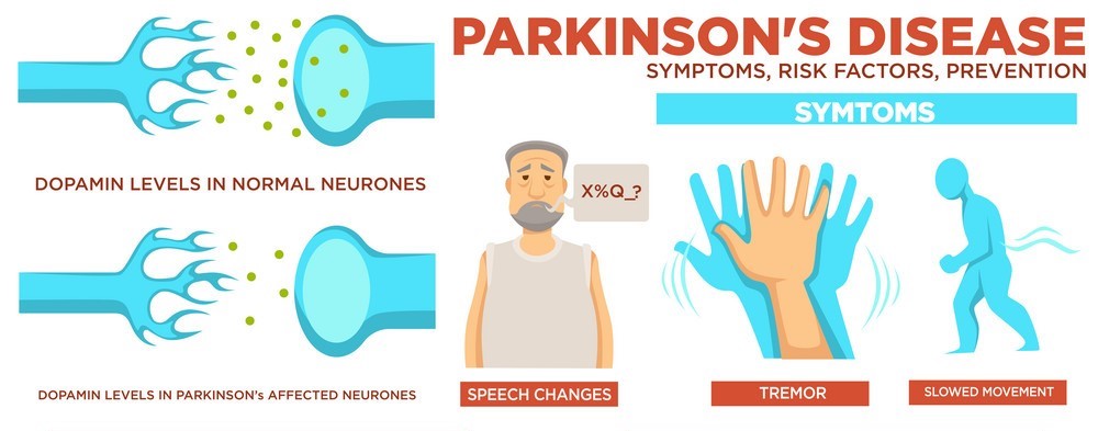 parkinson-1.jpg