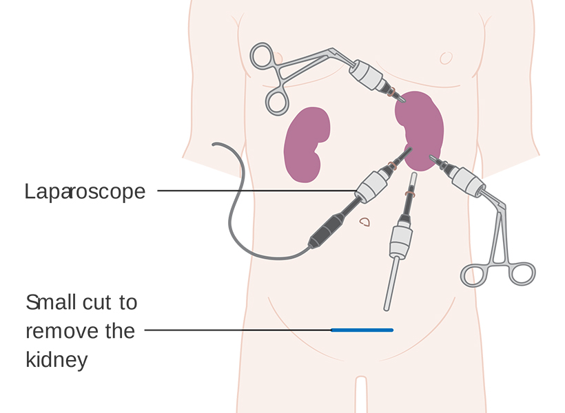 laparoscopy1.jpg