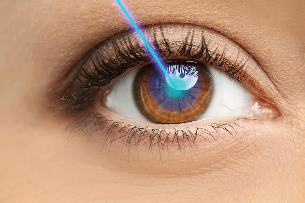 عمل فمتولیزیک (Femto-Lasik) چشم چگونه است؟